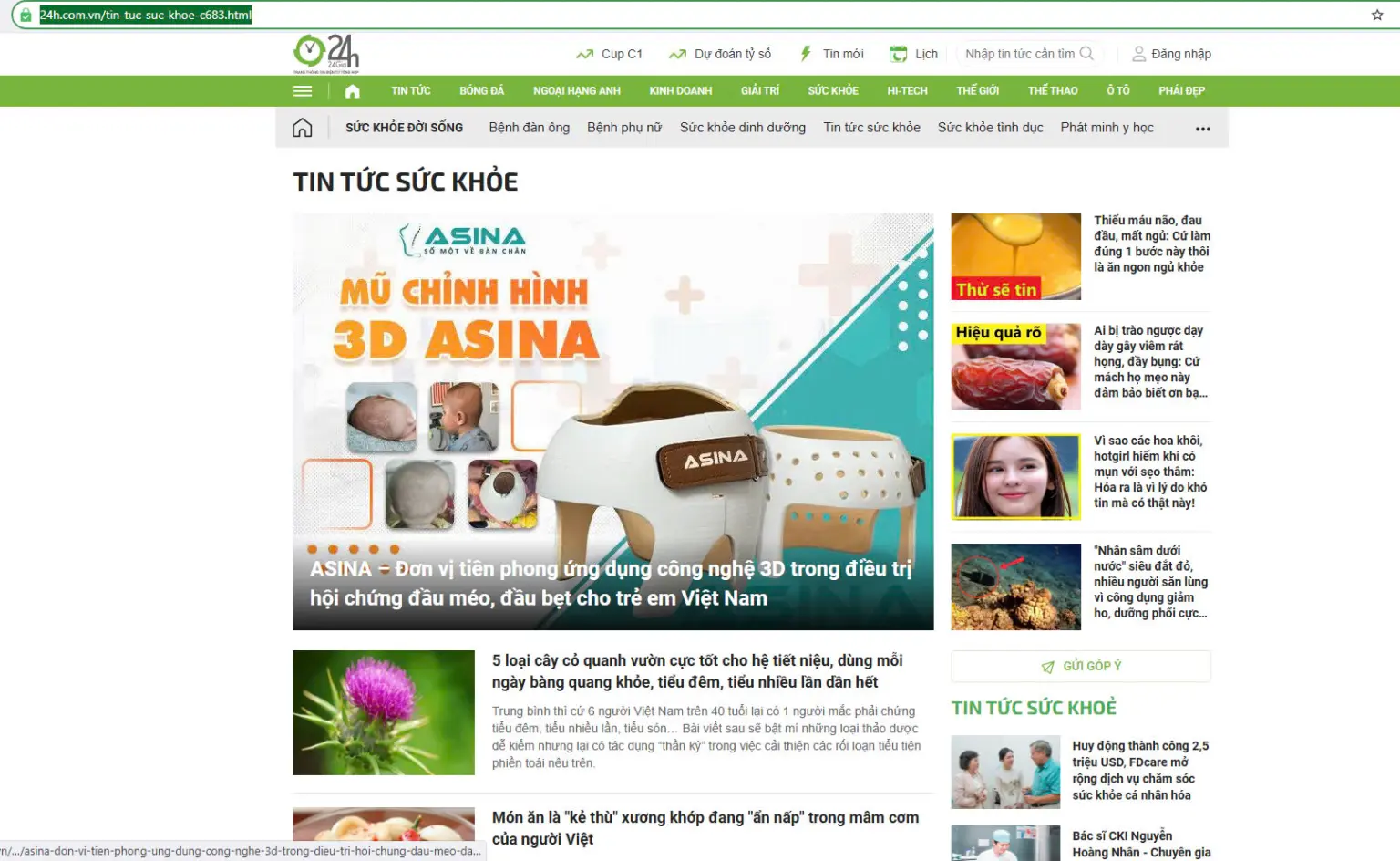 [24H] ASINA – Đơn vị tiên phong ứng dụng công nghệ 3D trong điều trị hội chứng đầu méo, đầu bẹt cho trẻ em Việt Nam