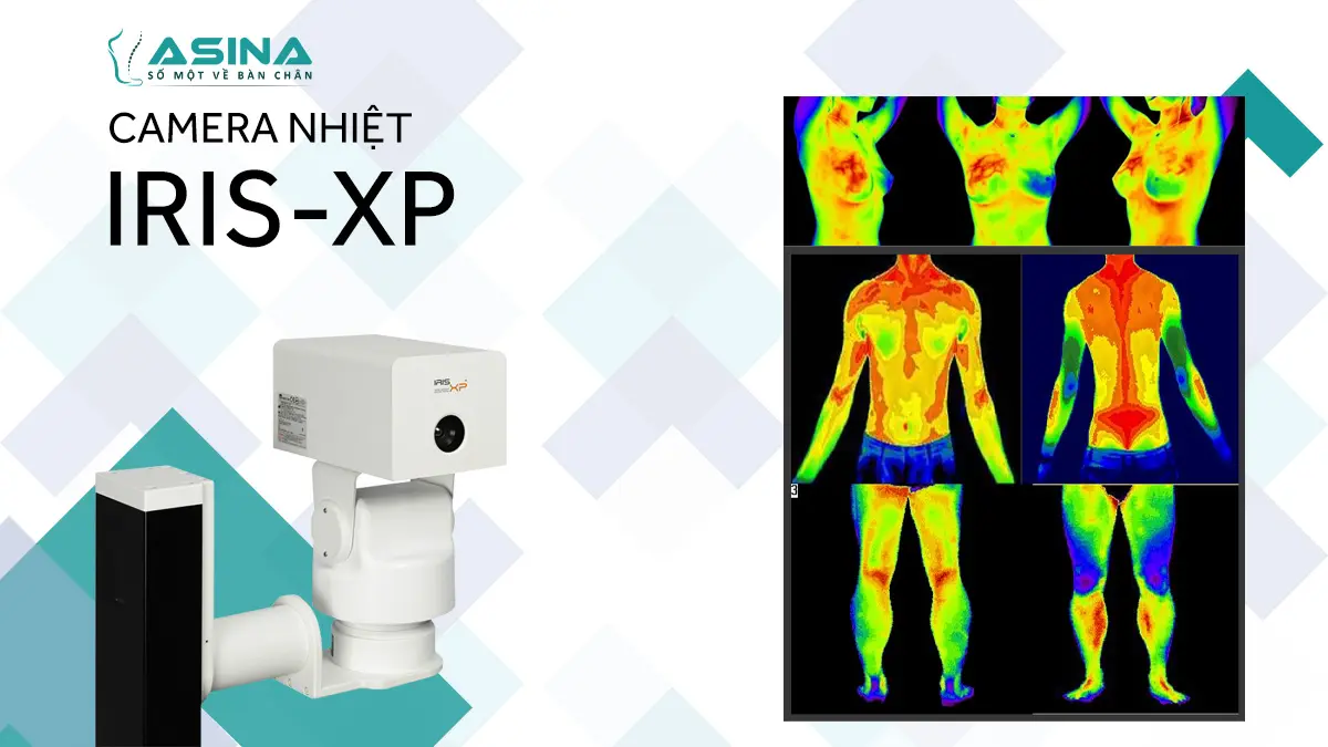 Công nghệ Camera chụp ảnh nhiệt IRIS-XP: Bước tiến mới trong tầm soát không xâm lấn tại ASINA